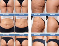 Anti-Cellulite Skin Firming Massage Oil